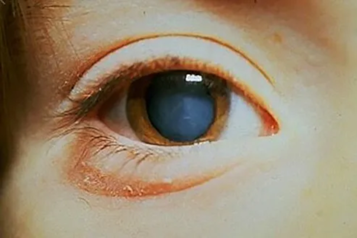 cc